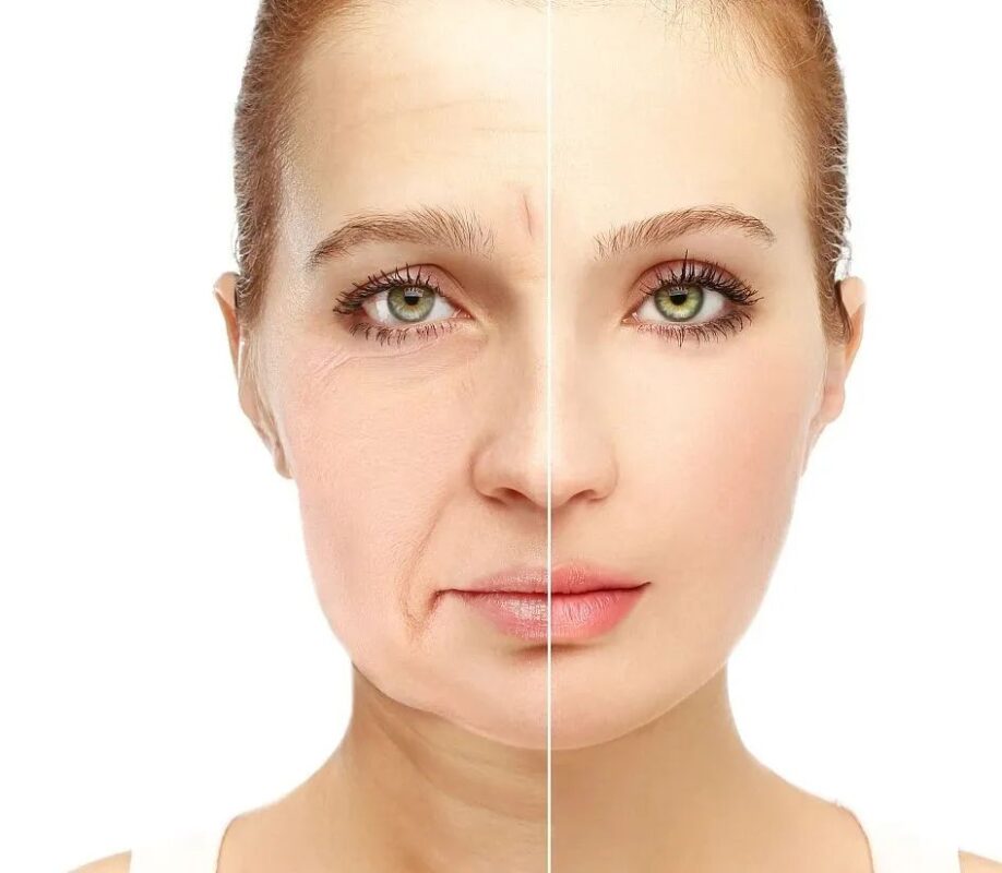 Botched Mini Face Lift How to Recognize and Fix It Nashville